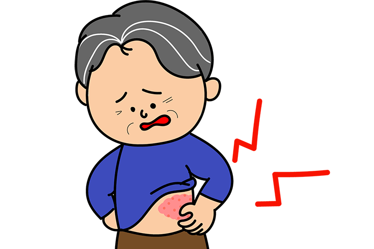 帯状疱疹のイメージイラスト